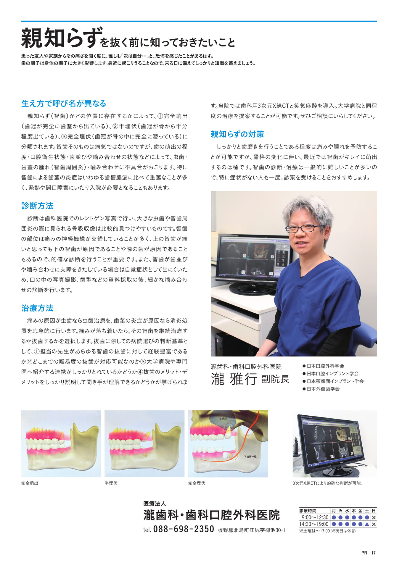 親知らずを抜く前に知っておきたいこと(19ページ目)
