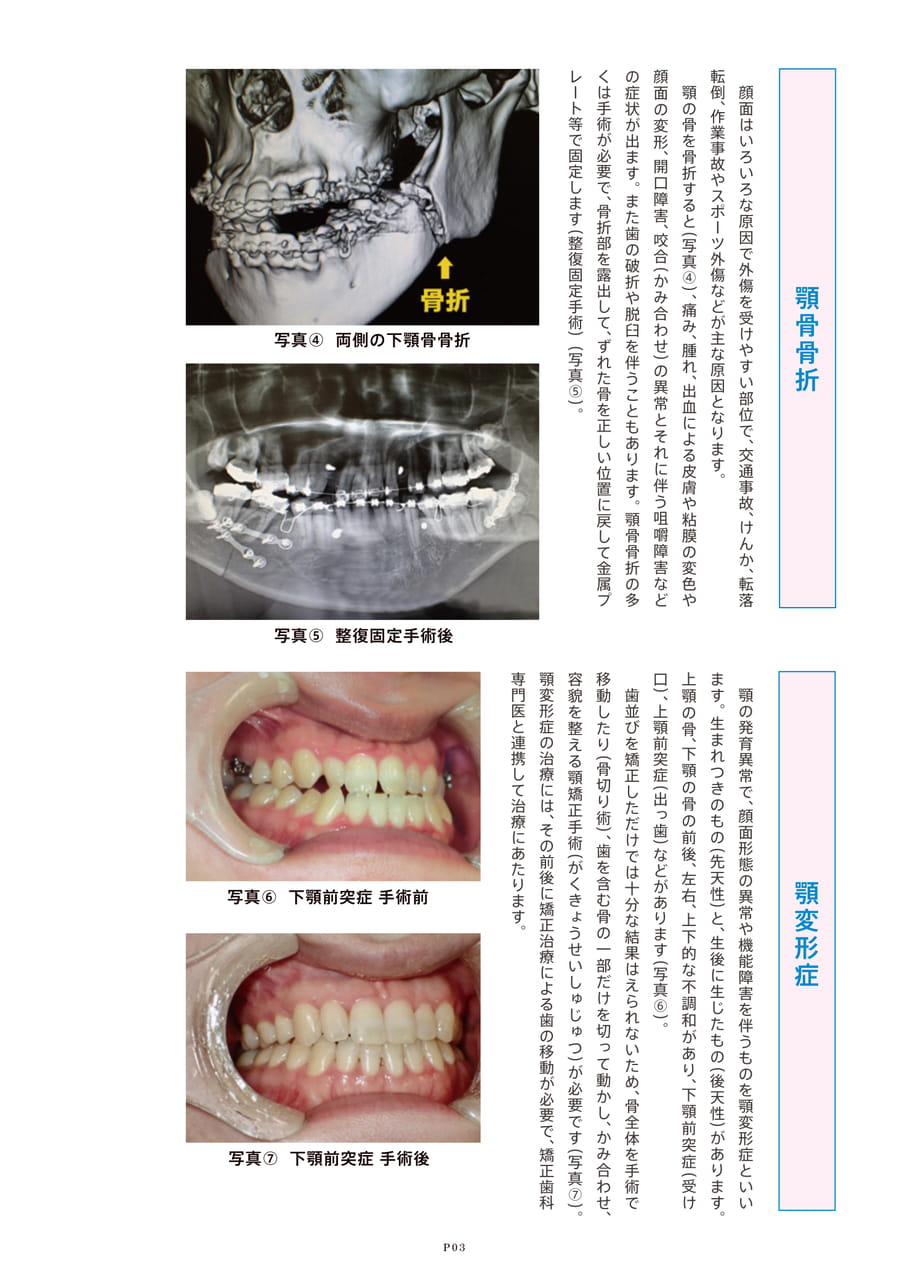 Page 4（4ページ目）